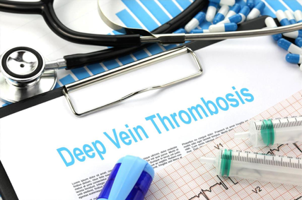 Vascular Surgeon for Blood Clots DVT